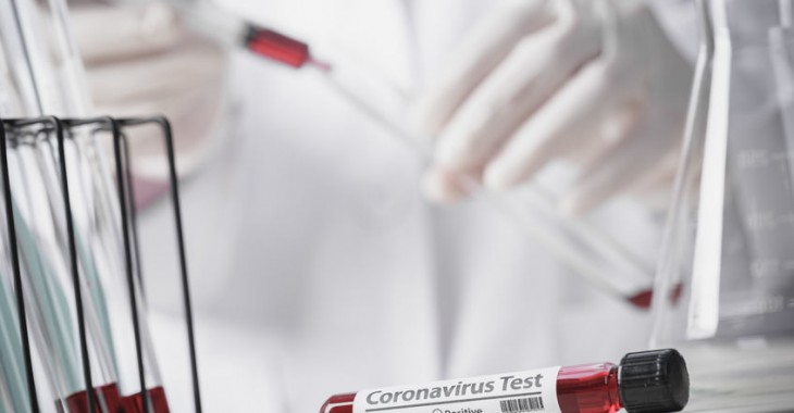 Główne obawy Polaków: dalszy wzrost cen żywności i możliwość zachorowania kogoś Główne obawy Polaków: dalszy wzrost cen żywności i możliwość zachorowania kogoś